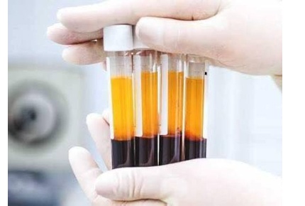 Плазмолифтинг со скидкой 50% в Ауре на Кирова