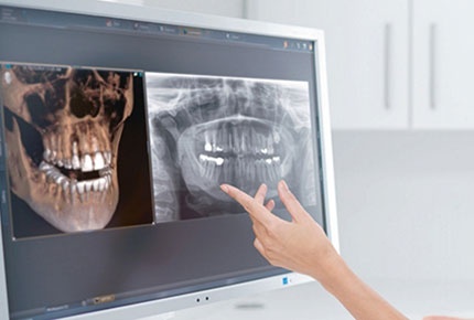 Компьютерная томография и консультация врача стоматолога со скидкой 85%