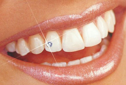 Комплексная ультразвуковая чистка зубов в стоматологии "Элеон" со скидкой 64%. Заплати 750 рублей вместо 2100